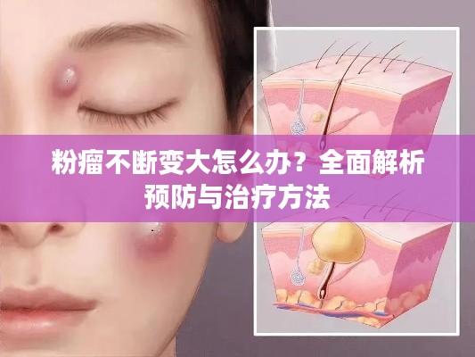 粉瘤不断变大怎么办?全面解析预防与治疗方法
