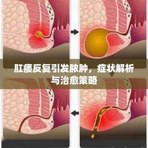 肛瘘反复引发脓肿，症状解析与治愈策略